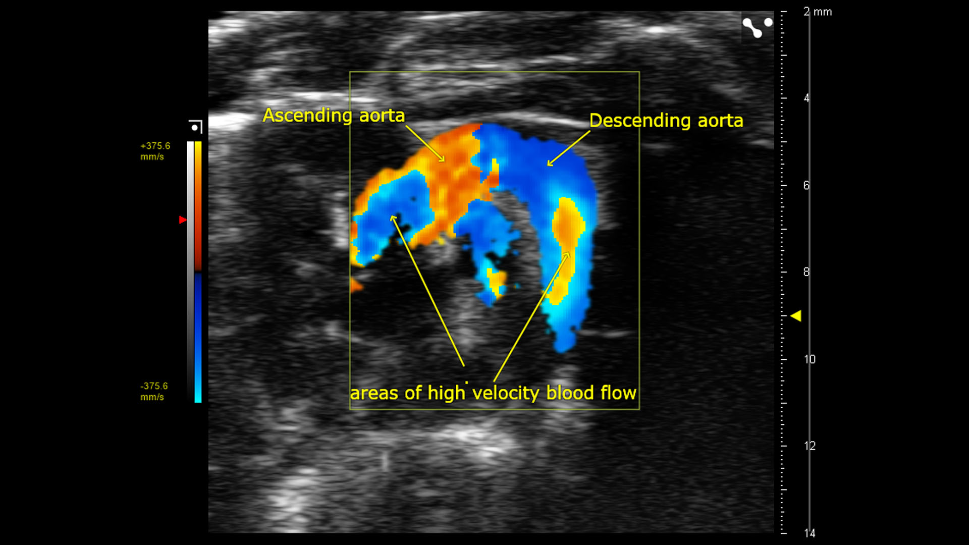 Color Doppler of Mouse Aortic Arch FUJIFILM VisualSonics